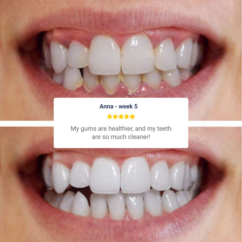GiftyDeals image